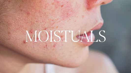 Moistuals Acne
