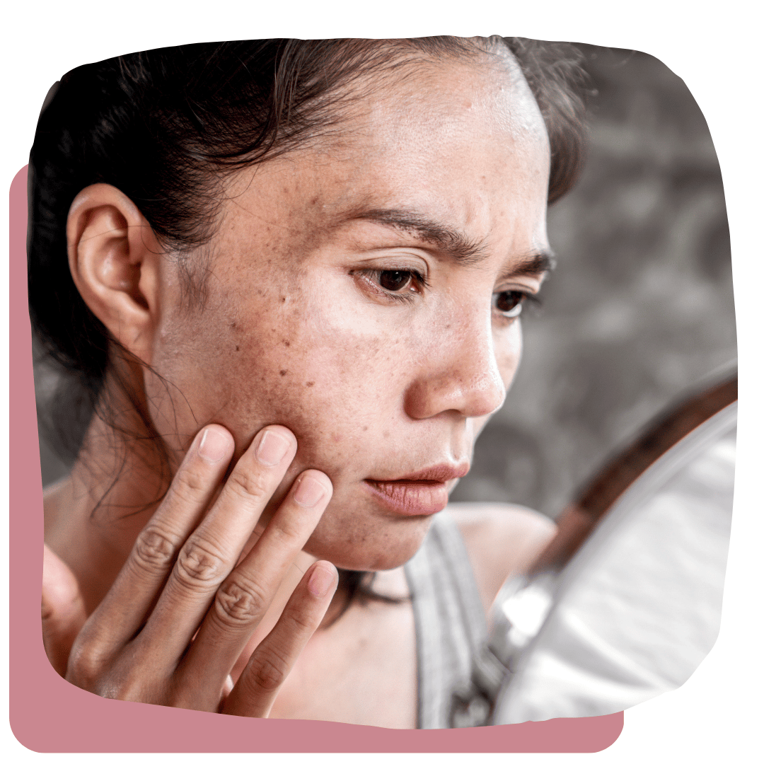 Dry Skin - Real Solutions For Thirsty Skin